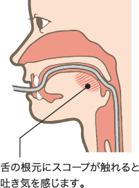口からの胃カメラ検査