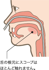 口からの胃カメラ検査